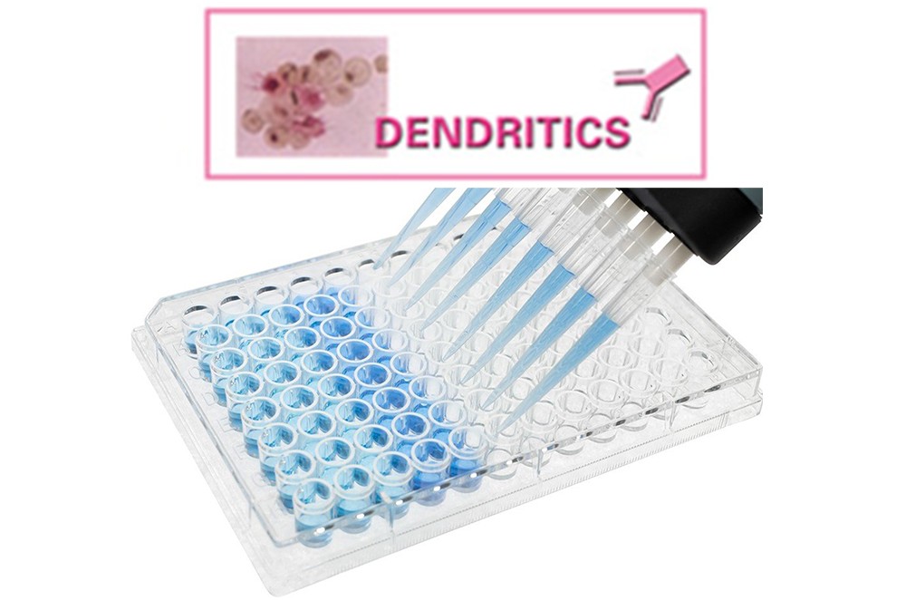 DDXK-E-TSLP ELISA Packege from Dendritics