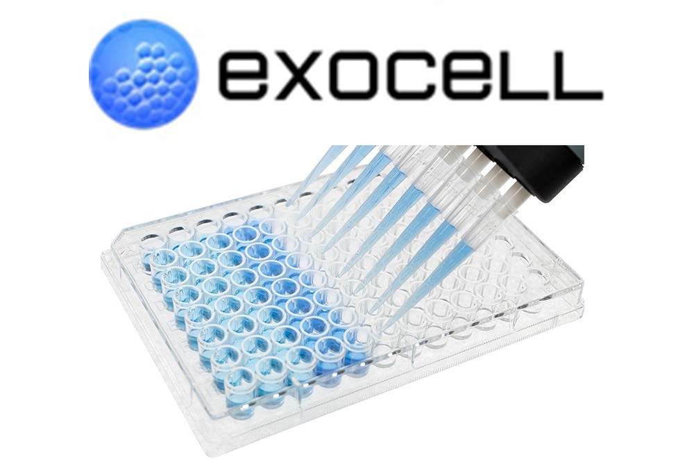 1025 ELISA Packege from exocell