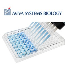 OKIA00010 Preview ELISA Packege from Aviva System Biology